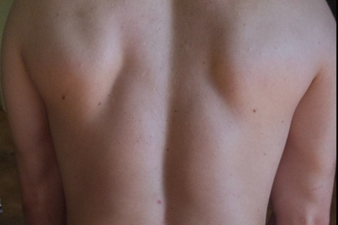 matirinaldi leaked gallery photo 2