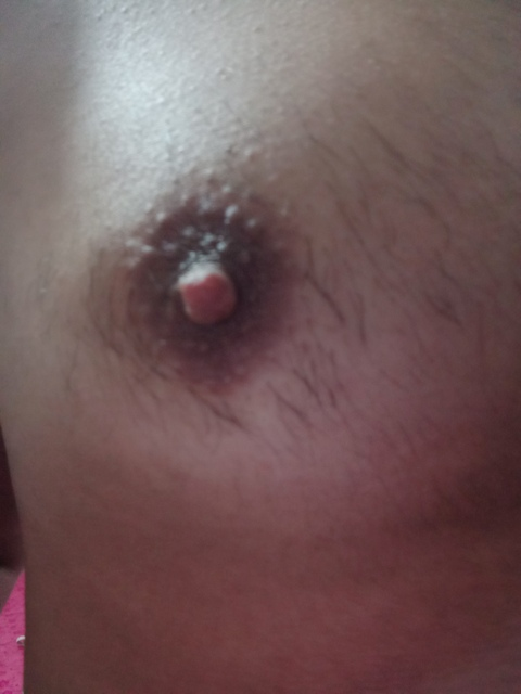 tetas leaked gallery photo 2